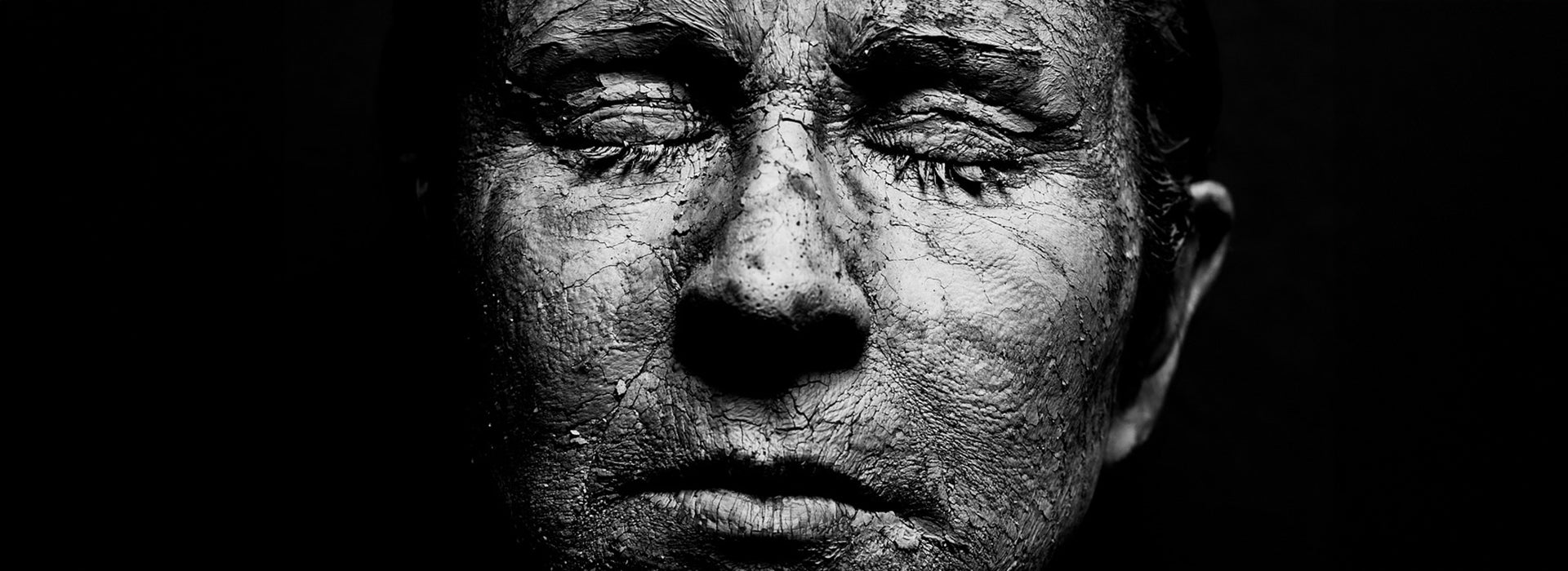 Neurodermitis – Ursachen und Risikofaktoren